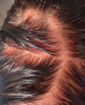 Knot bleaching service